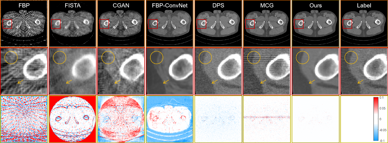 Data-iterative Optimization Score Model for Stable Ultra-Sparse-View CT
  Reconstruction