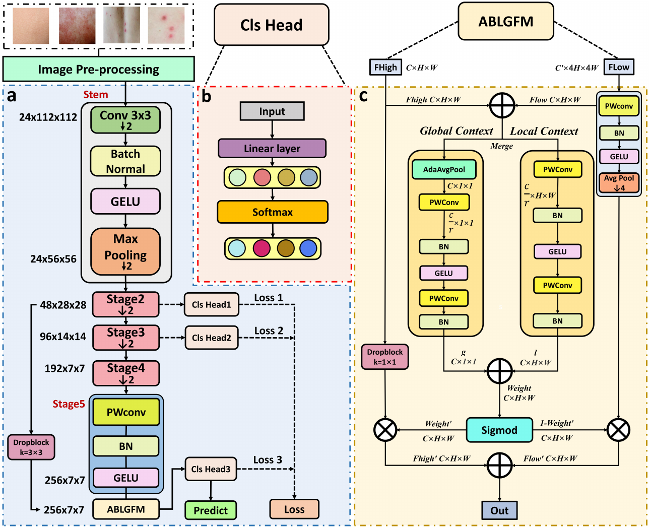 Ultrafast-and-Ultralight ConvNet-Based Intelligent Monitoring System for
  Diagnosing Early-Stage Mpox Anytime and Anywhere