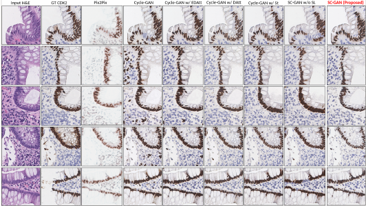 Structural Cycle GAN for Virtual Immunohistochemistry Staining of Gland
  Markers in the Colon