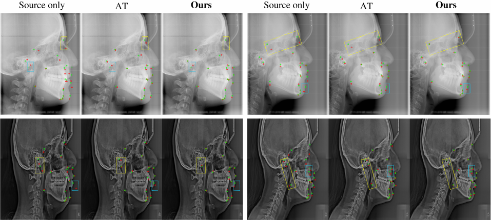 Unsupervised Domain Adaptation for Anatomical Landmark Detection