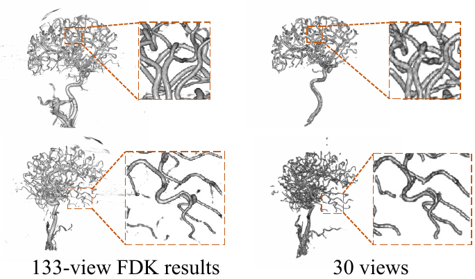 TiAVox: Time-aware Attenuation Voxels for Sparse-view 4D DSA
  Reconstruction