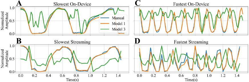 Video-Based Hand Pose Estimation for Remote Assessment of Bradykinesia
  in Parkinson's Disease