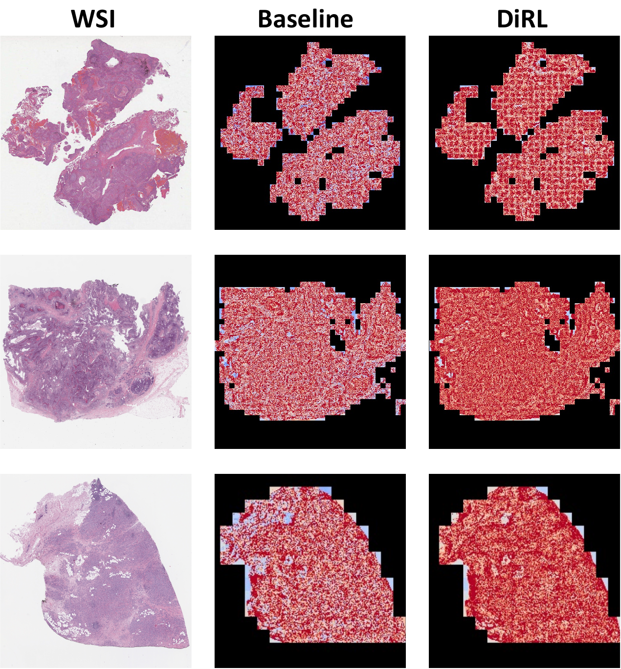 Attention De-sparsification Matters: Inducing Diversity in Digital
  Pathology Representation Learning