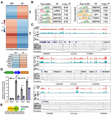 Upstream open reading frame inactivation augments GATA4 translation and cardiomyocyte hypertrophy in mice