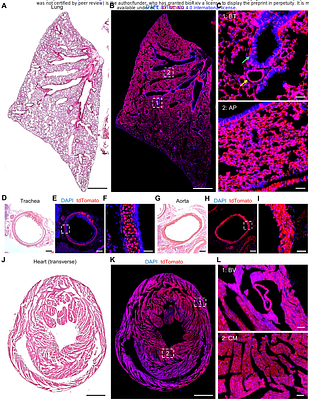 Organism-wide spatiotemporal profiling of gene expression utilizing a X-CreERT2/Ai9 tracing system