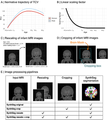 AI segmentation requires accounting for brain size to maintain performance on developmental MRI cohorts