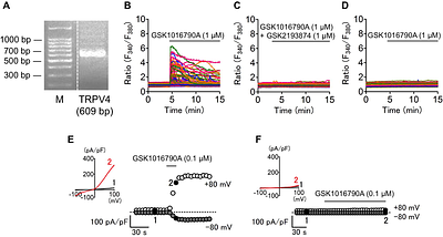 TRPV4 activation enhances LPS-induced IL10 production to suppress excessive microglial activation