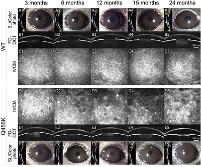 Interplay between ferroptosis and guttae in an early-onset murine model of Fuchs endothelial corneal dystrophy (FECD)
