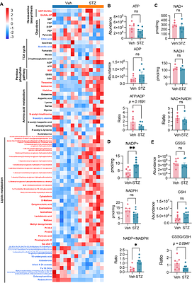 Metabolic adaptation to maternal hyperglycemia via ACLY-dependent acetyl-CoA production drives epigenetic remodeling and dysregulated placental development