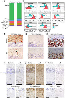 NETSseq Reveals Inflammatory and Aging Mechanisms in Distinct Cell Types Driving Cerebellar Decline in Ataxia Telangiectasia