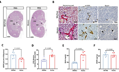 Bright Cells, and Inefficient Enzymatic Activity in a Renin Hypomorph Mouse