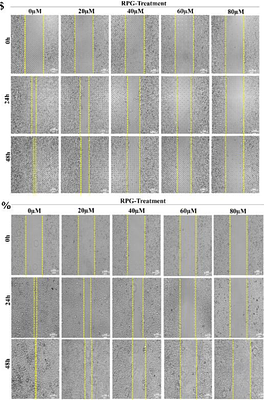 Anti-diabetic drug Repaglinide induces Apoptosis, Cell Cycle Arrest, and Inhibits Cell Migration in Human Breast and Lung Cancer Cells.