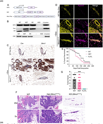 Miro1 knockout inhibits mouse breast cancer tumorigenesis