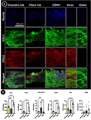 Spatiotemporal bioprinting of microtissues and growth factors within a support bath to engineer anisotropic, zonally defined meniscal grafts