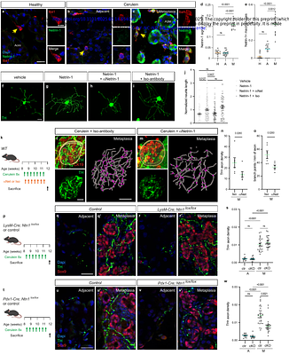 Neural function of Netrin-1 in precancerous lesions of the pancreas