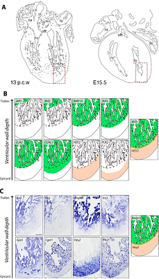 Patterning defects in mice with defective ventricular wall maturation and cardiomyopathy