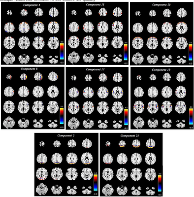 NeuroMark-HiFi: A Data-Driven Method for Detecting High-Spatial-Frequency Functional Brain Networks