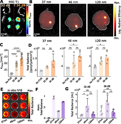 Data-driven feedback augments ultrasound nanotheranostics in brain tumors