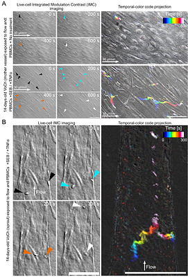Tunable Laminar Perfusion Coordinates Endothelial and Perivascular Remodeling in Angiogenic Vasculature-on-Chip