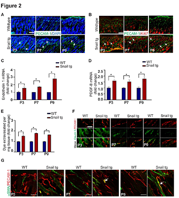 Angiopoietin-like protein 2 mediates vasculopathy driven fibrogenesis in a mouse model of systemic sclerosis