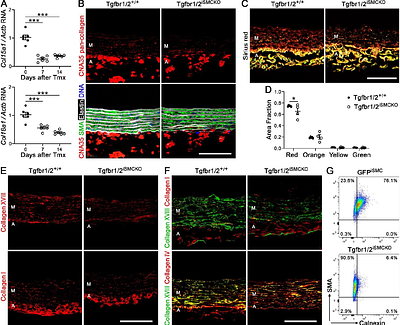 Short-Term Disruption of TGFβ Signaling in Adult Mice Renders the Aorta Vulnerable to Hypertension-Induced Dissection