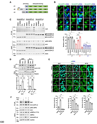 AMPKγ2 Deacetylation Drives Nuclear Translocation and Doxorubicin-Induced Cardiomyopathy via Nucleolar Stress Signaling