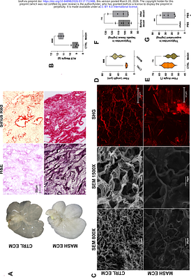 Unravelling the memory of the extracellular matrix using MASH-derived decellularized scaffolds