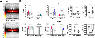 Probing relaxed myosin states in hypertrophic cardiomyopathy by second harmonic-generation microscopy