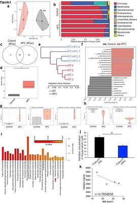 Gut-derived metabolic reprogramming drives immune aging and tissue degeneration