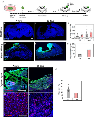 Histological assessment of integrated human cortical organoid grafts after controlled cortical impact