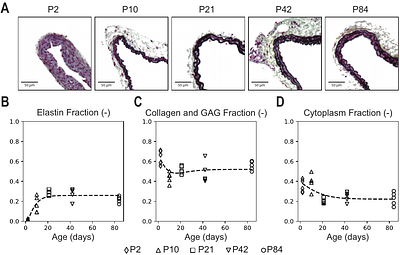 Postnatal Pulmonary Artery Development from Transcript to Tissue
