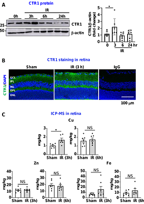 Novel Role of Copper Transporter CTR1 and Therapeutic Potential of Copper Chelators in Retinal Ischemia-Reperfusion Injury