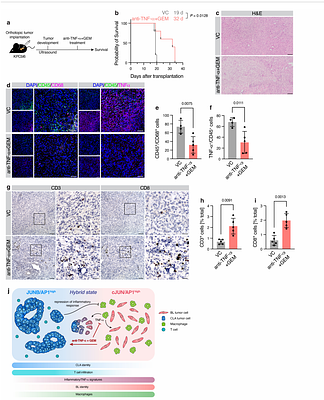 Spatial tumor immune heterogeneity facilitates subtype co-existence and therapy response via AP1 dichotomy in pancreatic cancer