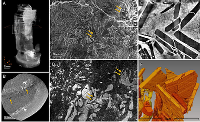 Cell-mediated cholesterol crystal processing and clearance observed by 3D cryo-imaging in human atherosclerotic plaques