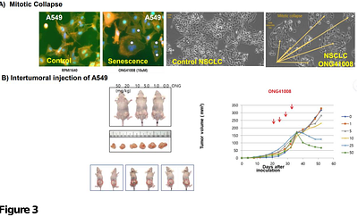 Sequential Activation of Senescence and Apoptosis by ONG41008 Eliminated the Human Pancreatic Ductile Adenocarcinoma in nude mice and xenografted human lung cancer