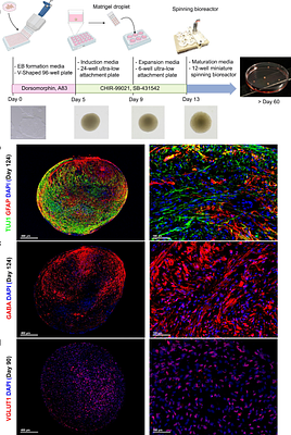 Metabolic analysis in intact human-derived cerebral organoids by high-resolution magic-angle spinning NMR spectroscopy