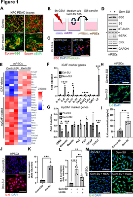Tumor Cell Death Drives Tumor-Promoting IL-6+ iCAF formation via P2X7-activation