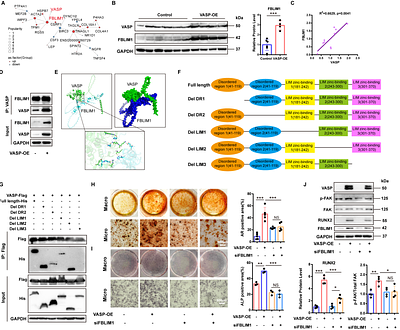 VASP Promotes Aortic Valve Calcification by Interacting with FBLIM1 to Activate the Focal Adhesion Pathway