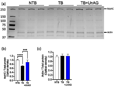 Unacylated Ghrelin Counteracts Contractile and Mitochondrial Dysfunction in Cancer Cachexia