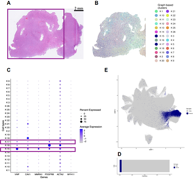 Cross-Modal Training Using Xenium Spatial Transcriptomics Enables DINO-DETR Based Detection of Vascular Niches in H&E Whole-Slide Images