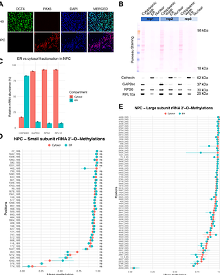 Cytosolic and ER-associated ribosomes share rRNA 2'-O-methylation landscapes across human cell types