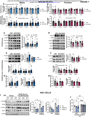 β-cell NCK1 is reduced in type 2 diabetes, leading to inefficient β-cell UPR and insulin secretion and revealing sex-specific adaptation during metabolic stress