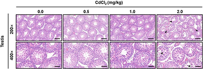 Cadmium Disrupts Blood-Testis Barrier (BTB) via An Oxidative Stress-Dependent Autophagy in Prepubertal Rats