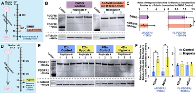 Regulation of PDGF-BB Signaling in Placental Pericytes by Soluble PDGFRβ Isoforms: Implications for Fetoplacental Vascular Development