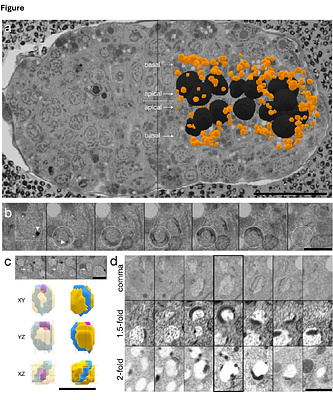 The 3D Ultrastructure of C. elegans Gut Granules