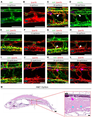 A Conserved Venous Remodeling Program Governs Inferior Vena Cava Formation in Zebrafish