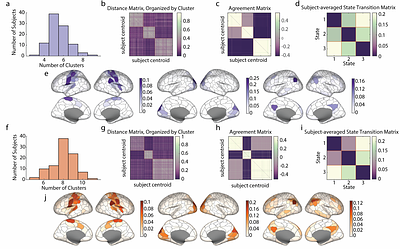Time-varying synergy/redundancy dominance in the human cerebral cortex