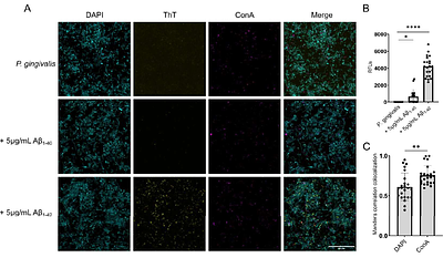Bi-directional relationship between the biofilm of Porphyromonas gingivalis and the amyloid-beta peptide.