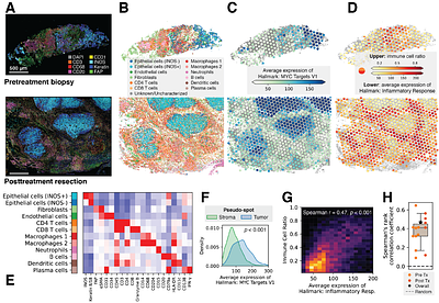 Spatial multi-omics and deep learning reveal fingerprints of immunotherapy response and resistance in hepatocellular carcinoma