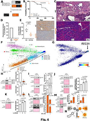Autophagy driven by VPS34 enables differentiated cell plasticity and cancer initiation